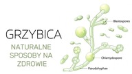 Naturalne Sposoby na Grzybicę Które Musisz Znać