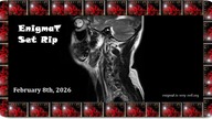 Disco Dice - Silver Surfer (Ronski Speed Remix) (Cut From Ronski Set)-enTc